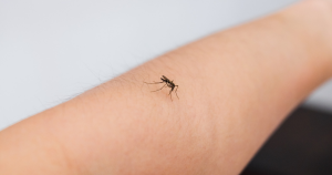 How to Effectively Treat Mosquito Bites